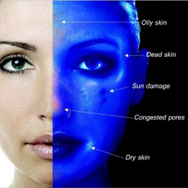 ANÁLISIS DE ROSTRO CON LÁMPARA WOOD