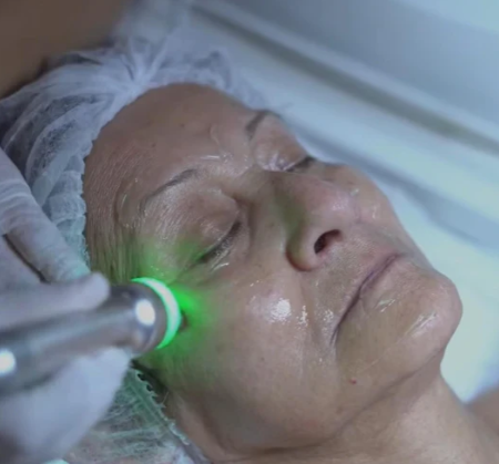 HYDRAFACIAL STANDARD