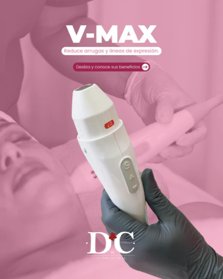 TRATAMIENTO HIFU V-MAX